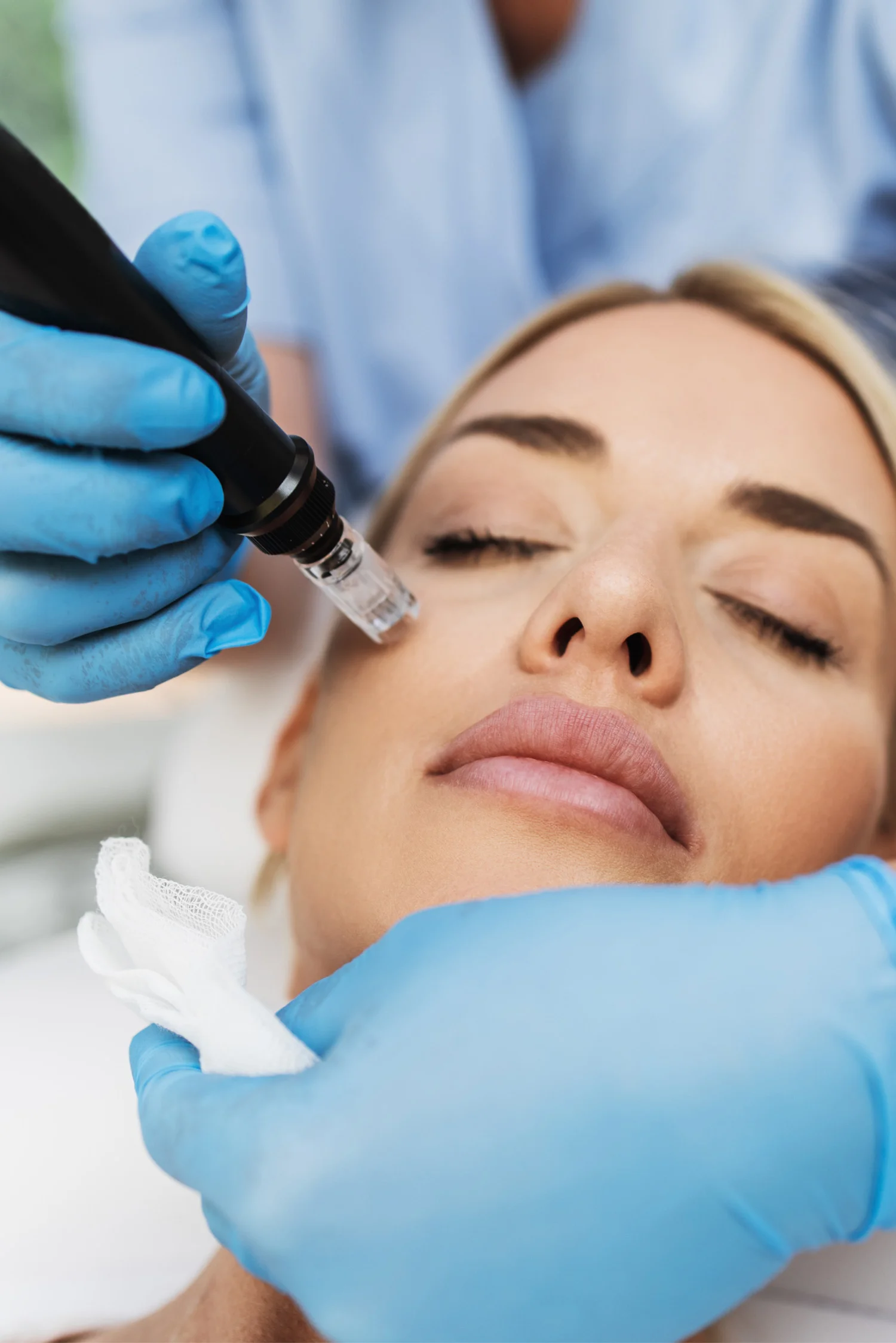 Dermal Fillers